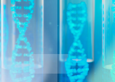Modeling Huntington Disease progression to de-risk Phase III trials